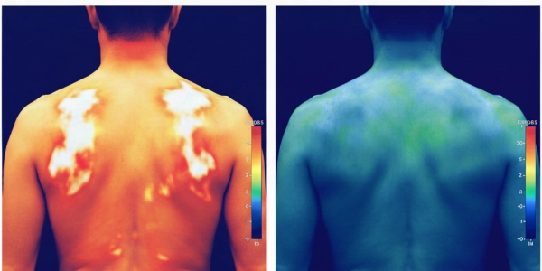 Earthing contra el Dolor | Antiinflamatorio Natural